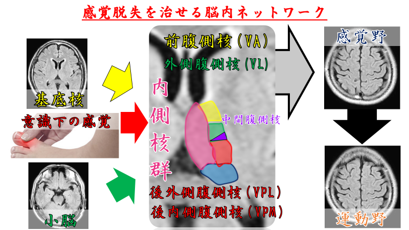 脳科学 脳画像 Brs 感覚脱失治療編 Apa S 網様体 前庭系 ニューロリハに着目した 最新知識 実技 リハビリ で使える脳科学知識と技術によるbrsの改善 大阪会場 Pt Ot St Net