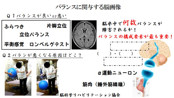 ナイトセミナーシリーズ バランスに特化した脳画像の見方と解釈 苦手な脳画像が得意になる2時間 Pt Ot St Net