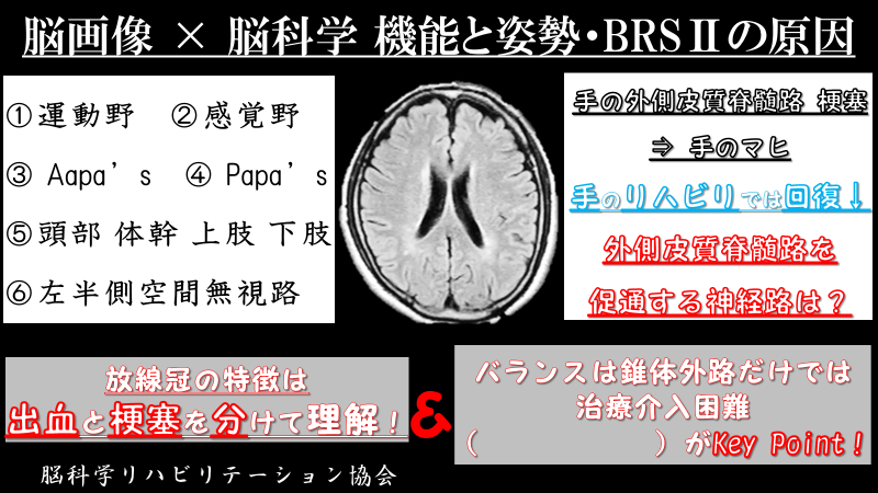 PT・OT・STのための脳画像のみかたと神経所見 zonaamarela.com.br