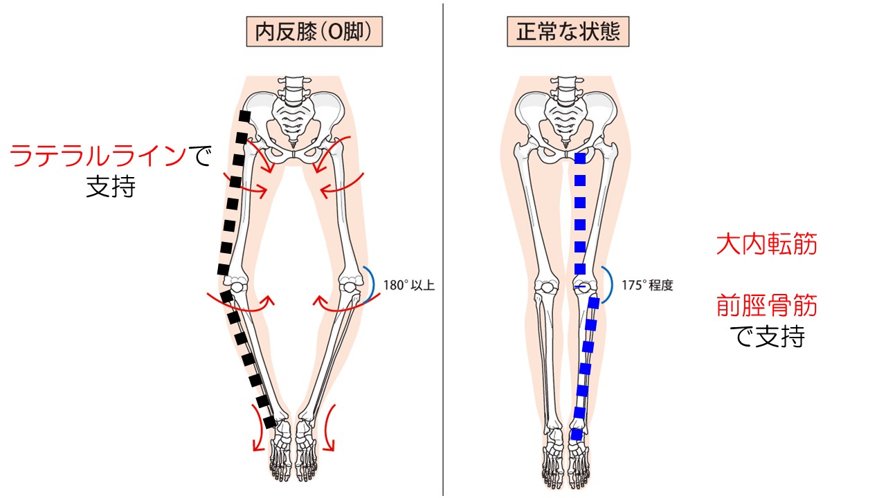 中川D.Cカイロプラクティック股関節／膝関節の検査と治療 - CD・DVD 