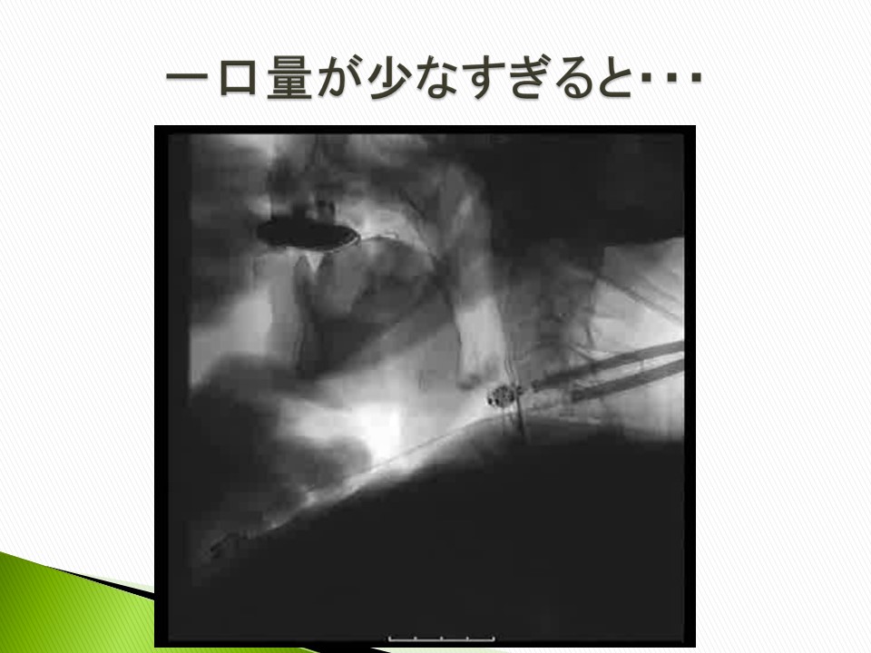 頸部聴診法Webセミナー】②全編「症例検討」でみっちり学ぶ！ 頸部聴診