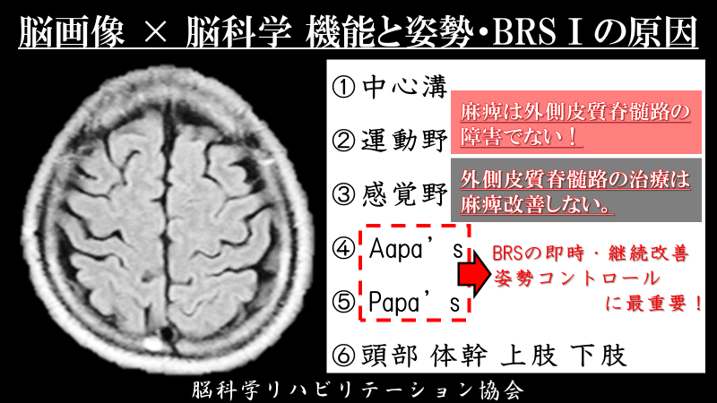 ＢＲＳ　脳科学　×　×　脳画像