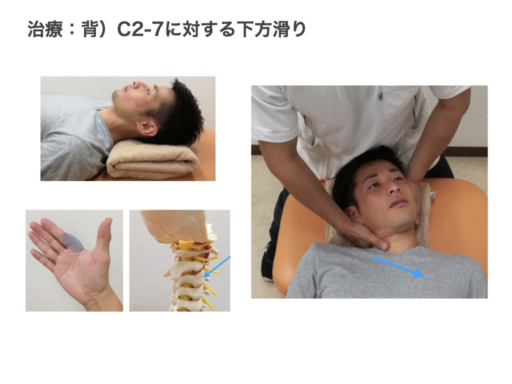 脊椎徒手療法コース６ 頚椎の評価と治療｜PT-OT-ST.NET