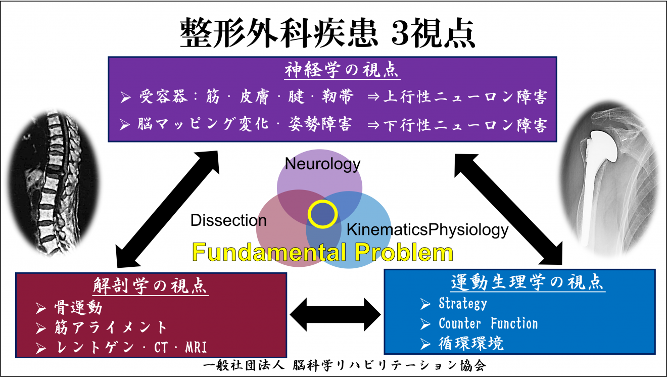 上肢運動器疾患の診かた・考えかた 関節機能解剖学的