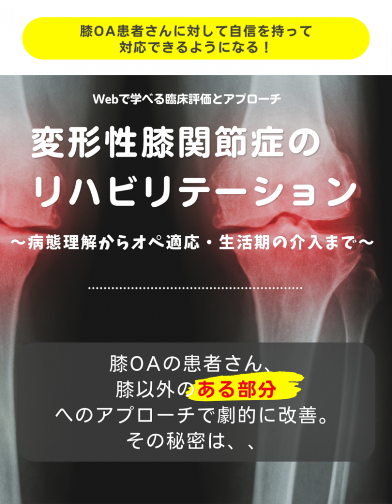 変形性関節症 : 何を考え、どう対処するか - 健康/医学